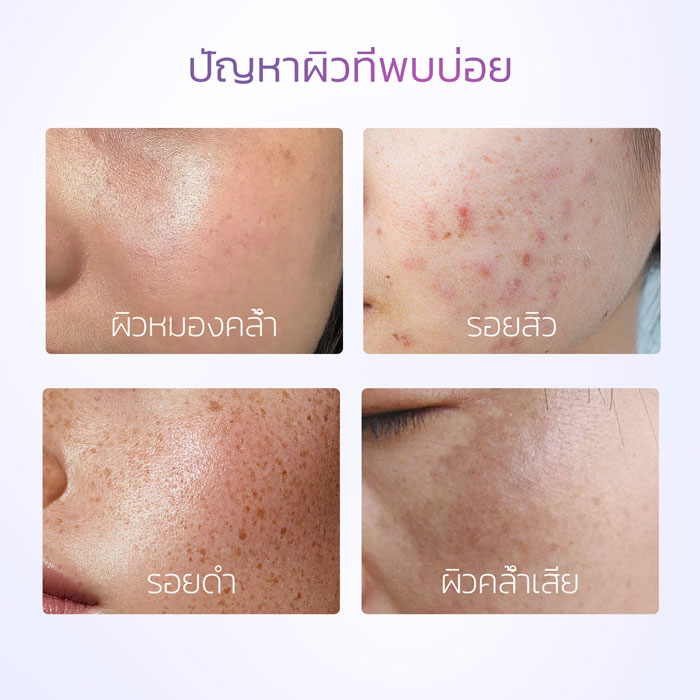 เซรั่ม Skintific Symwhite 377 Dark Spot Serum