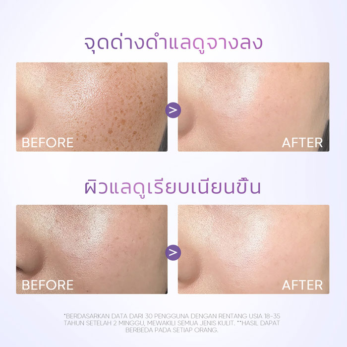 เซรั่ม Skintific Symwhite 377 Dark Spot Serum