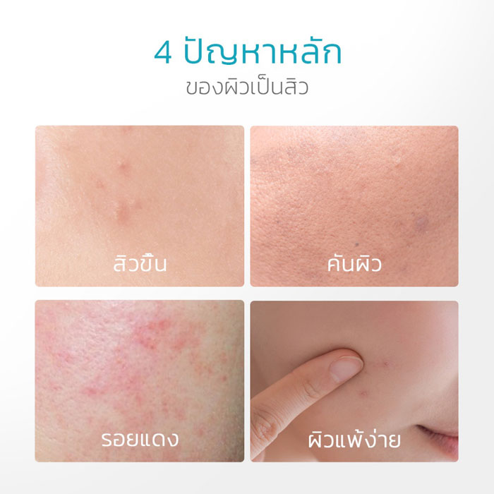 ครีมบำรุงผิวหน้า Skintific  5% Panthenol Acne Calming Water Gel